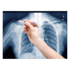 Edding 8010 marqueur spécial radiologie (0,8 mm ogive) - blanc 4-8010049 239197 - 3